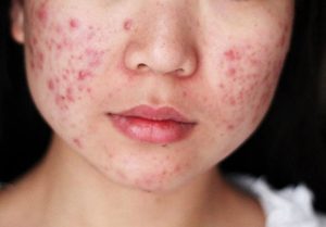 Mỹ Phẩm Chính Hãng – Bí Quyết Chăm Sóc Sắc Đẹp An Toàn Và Hiệu Quả - 2026